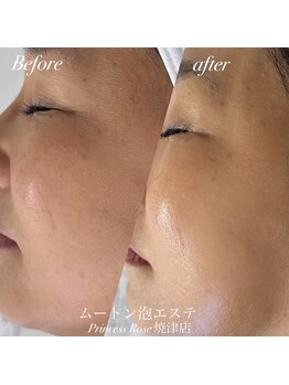 プリンセスローズ 焼津店(Princess Rose)/ムートン泡エステ