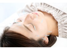 辻野夢鍼灸院/ビューティケア鍼灸コース