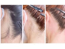 ミューシェリー(Mieux Cherie)/うなじのお手入はシュガーリング