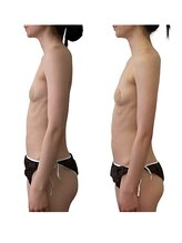 ベンザイ 新潟店(BENZAI)/筋肉が少ないバストが崩れやすい