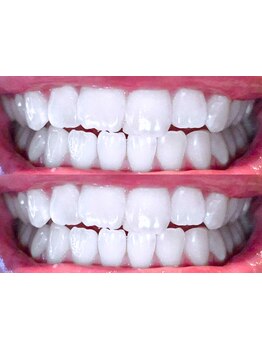 お肌をきれいにしたい