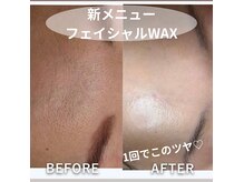 ちゅるん肌目指すならまずは『産毛処理』から♪