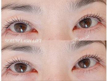 アットイース(at ease)/