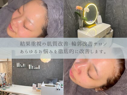 リリー(LILLY)の写真