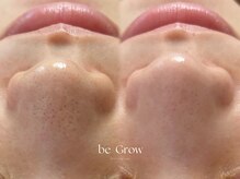 ビーグロウ(be Grow)