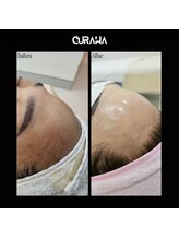 パールブルー(All Perl blue)