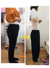 美容整体スズキ(SUZUKI)/別人級変化