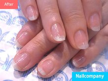 ネイルカンパニー/