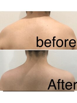 リアン(Ri'an)/リンパ★ビフォーアフター