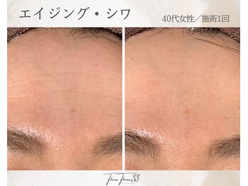 スリースリー(THREE THREE)/エイジング・しわケア