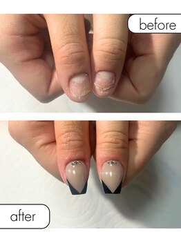 ピノ(pino)/◆深爪矯正＋長さだしアート◆