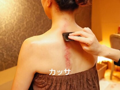 ソルーナ(So-Luna)の写真