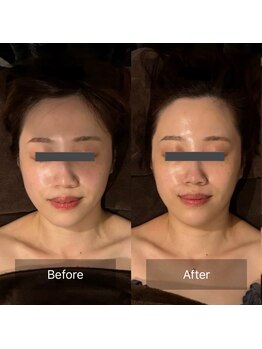 グレースフィオーレ 京橋店(gracefiore)/Before/After( 1回施術)