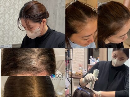 リベルテ(Liberte)の写真