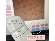 ステラ(Stella)の雰囲気（毛穴は千差万別！独自開発スコープカメラでトラブルを可視化◎）