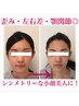 【左右差・歪み・顎関節の悩み解消】Naoの圧倒的シンメトリー小顔美人矯正