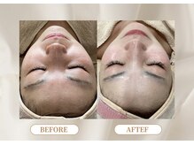 トロワ(TROIS)/首やデコルテまできれいに。