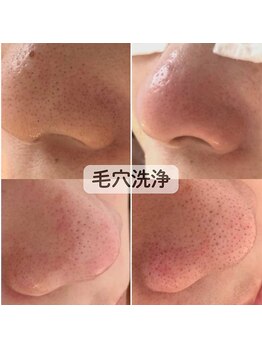 ココロ(COCORO)/毛穴洗浄