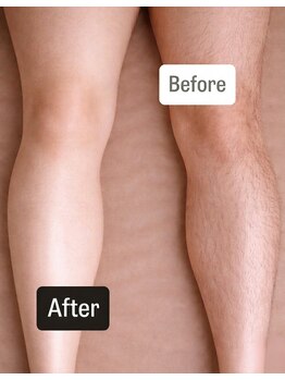 イニティウム 清澄白河(initium)/【メンズ両足上下WAX】