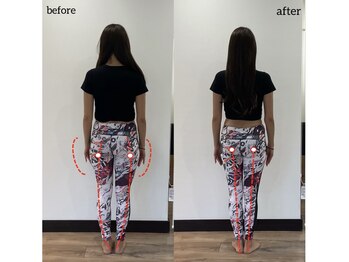 ワクワクボディ 横浜店(WAKUWAKU BODY)/30代|3か月|お尻の形・O脚改善
