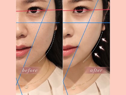 チキバン美容鍼灸整体サロン 心斎橋店の写真