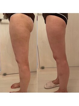 メゾン アンジュ(Maison Ange)/脚4回目/レモンボトル