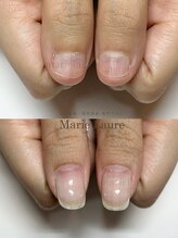マリーロール 淀屋橋本店(Marie Laure)/自爪育成/深爪矯正/ネイルケア