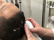 フェイシャル専門サロン サロン ド ウイッシュ/【頭髪促進】頭皮クレンジング