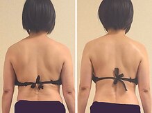 リンド(Lindo)/筋膜リリース