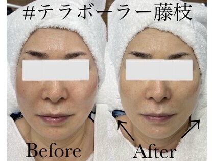 エステサロン ソワンの写真