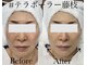 エステサロン ソワンの写真