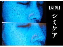 The水光美肌専科/塗るだけで大丈夫！