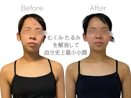 美容整体 綾の写真