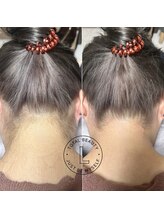 ブラジリアンワックス脱毛サロン ルラ 恵比寿(Lula)/うなじワックス/Before &after