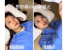 トップフェイス(Top Face)の雰囲気（施術後は大満足の効果が◎）