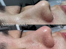 ナチュールムーン(Nature moon.)/毛穴洗浄