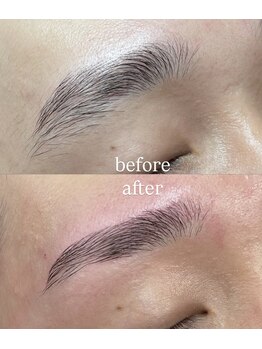 ケープラス(K Plus+)/before→after