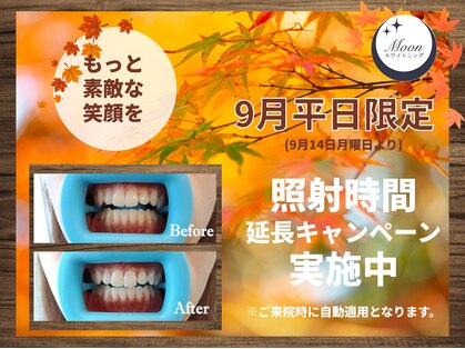 ムーンホワイトニング(Moonホワイトニング)の写真