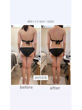 トランキーロ(Tranquilo)/浮腫やすい方は大満足強圧リンパ