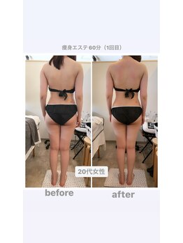 トランキーロ(Tranquilo)/浮腫やすい方は大満足強圧リンパ