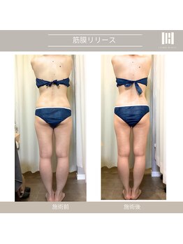 カリスボーテ 関本店/リピートNO.1筋膜リリース