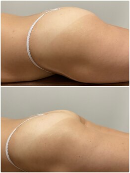 サロン ド アヴニール(SALON de AVENIR)/バストケア☆全身筋膜リリース