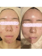 アユアランリンク 札幌店/1ヵ月でトラブル軽減！