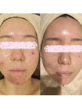 アユアランリンク 札幌店/1ヵ月でトラブル軽減！