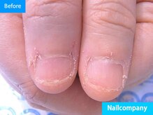 ネイルカンパニー/