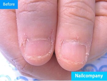 ネイルカンパニー/