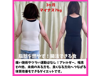 アロハウス(ALOHOUSE)の写真