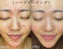 インディビューティー 六本木店(inde beauty)