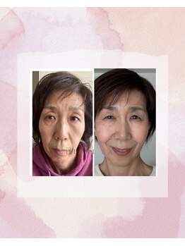 ローズリリーブ/私の変化