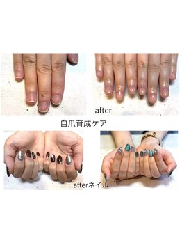 爪の悩みを解消できる（ケア含む）